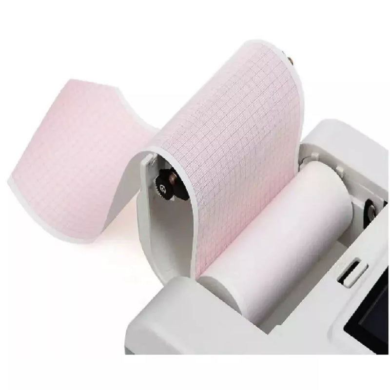 12-lead ECG recording, thermal printer, and USB connectivity for hospitals and clinics