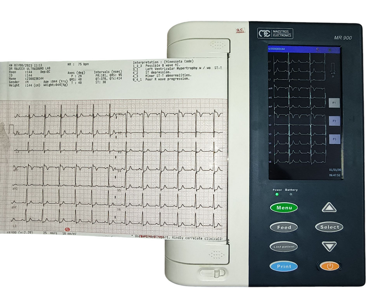 Maestros electronics MR 900 ECG Machine 