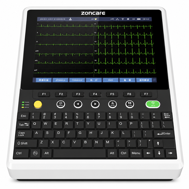 Compact Zoncare U90 digital ECG machine for bedside, emergency, and mobile cardiac diagnostics