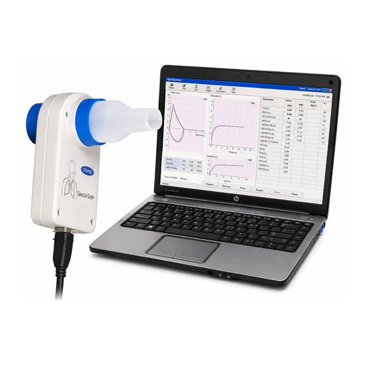 Clarity SpiroTech hand-held PC-based spirometer unit connected to a laptop running pulmonary function testing software for real-time respiratory waveform and data analysis.