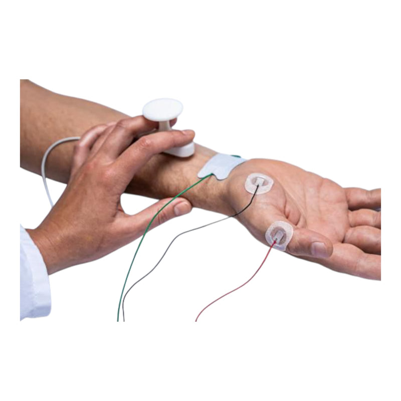 Clinician placing the Ambu Neuroline 715 Ag/AgCl surface electrode for a nerve conduction study.
