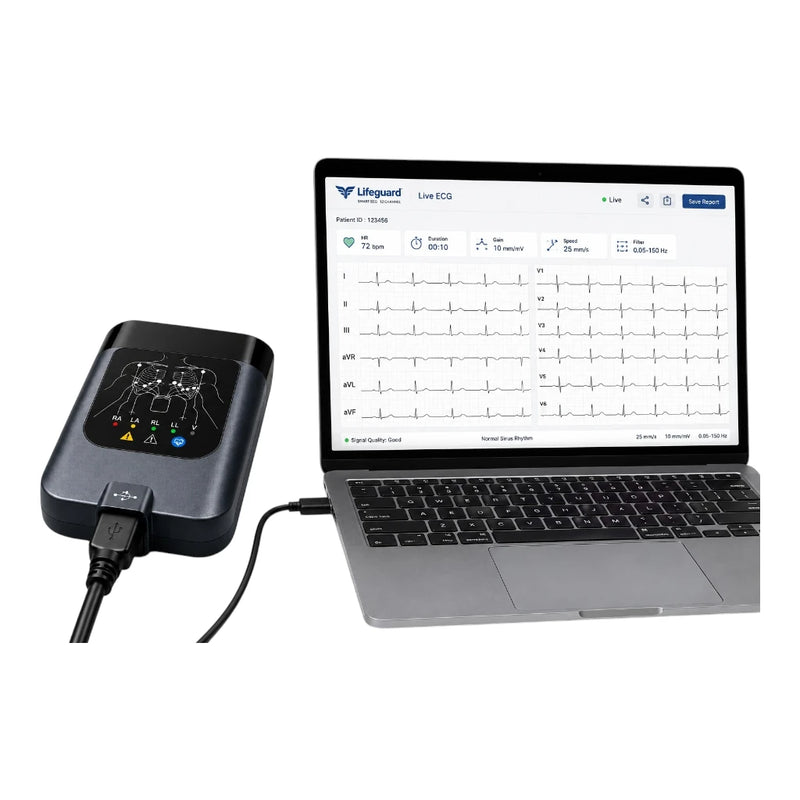 Lifeguard 12-channel smart PC ECG machine connected via USB to a laptop displaying a real-time live ECG waveform graph on the screen.