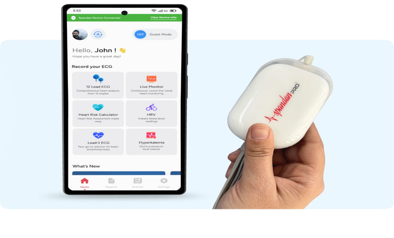 Sunfox Spandan Pro Portable 12-Lead ECG Machine For Hospital/Clinic